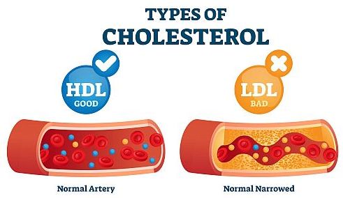Fitosteroli in holesterol
